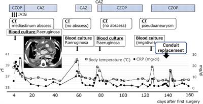 Case Report: 18F-FDG PET-CT for Diagnosing Prosthetic Device-Related Infection in an Infant With CHD